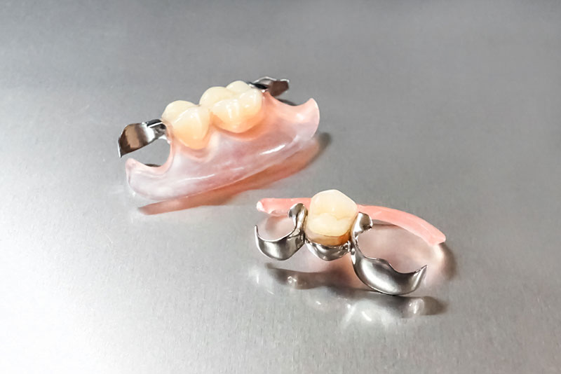 コンティース入れ歯|こみね歯科医院